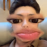 Lim